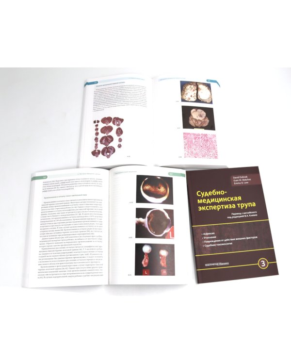 Судебно-медицинская экспертиза трупа: В 3-х т.; + Правила формулировки судебно-медицинского и патологоанатомического диагнозов (комплект из 4-х нкиг)