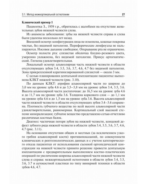 Костная пластика перед дентальной имплантацией: Учебное пособие