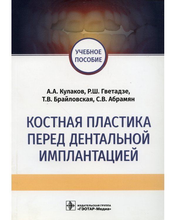 Костная пластика перед дентальной имплантацией: Учебное пособие