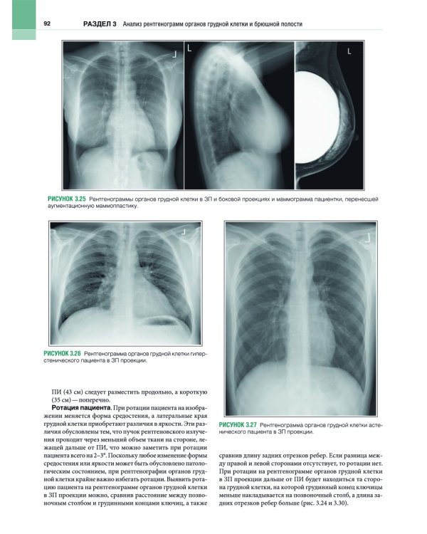 Рентгенология. Техника исследований и анализ изображений. В 2 ч. (комплект из 2 кн.)