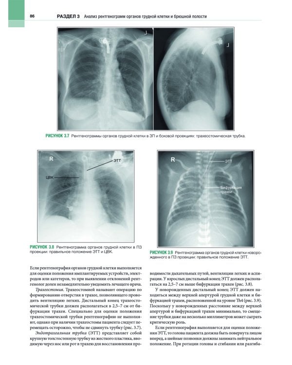 Рентгенология. Техника исследований и анализ изображений. В 2 ч. (комплект из 2 кн.)