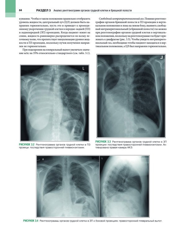 Рентгенология. Техника исследований и анализ изображений. В 2 ч. (комплект из 2 кн.)