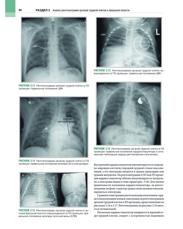 Рентгенология. Техника исследований и анализ изображений. В 2 ч. (комплект из 2 кн.)