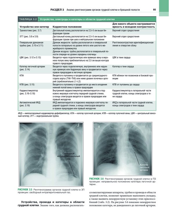 Рентгенология. Техника исследований и анализ изображений. В 2 ч. (комплект из 2 кн.)