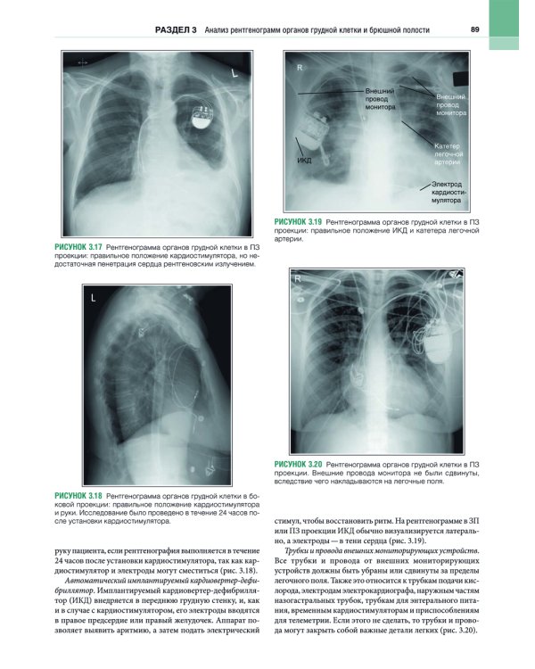 Рентгенология. Техника исследований и анализ изображений. В 2 ч. (комплект из 2 кн.)