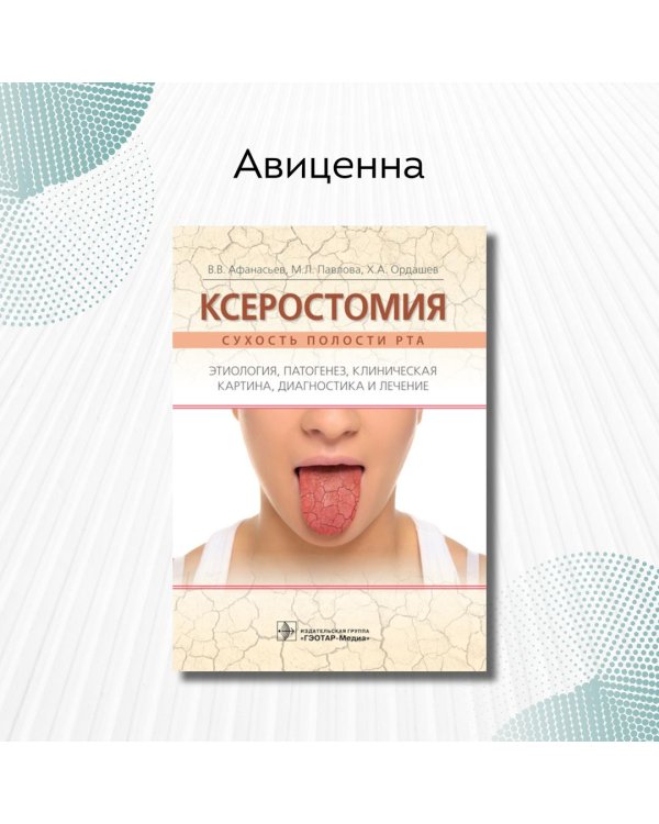 Ксеростомия. Сухость полости рта. Этиология, патогенез, клиническая картина, диагностика и лечение