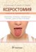 Ксеростомия (сухость полости рта). Этиология, патогенез, клиническая картина, диагностика и лечение