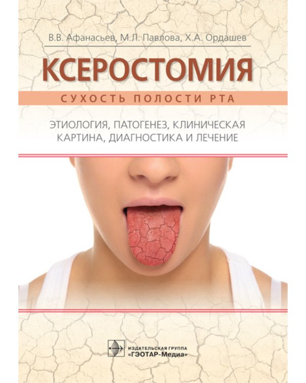 Ксеростомия (сухость полости рта). Этиология, патогенез, клиническая картина, диагностика и лечение