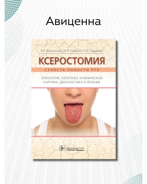 Ксеростомия. Сухость полости рта. Этиология, патогенез, клиническая картина, диагностика и лечение