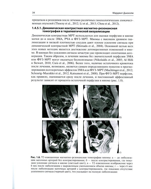 Мини-инвазивная гинекологическая хирургия