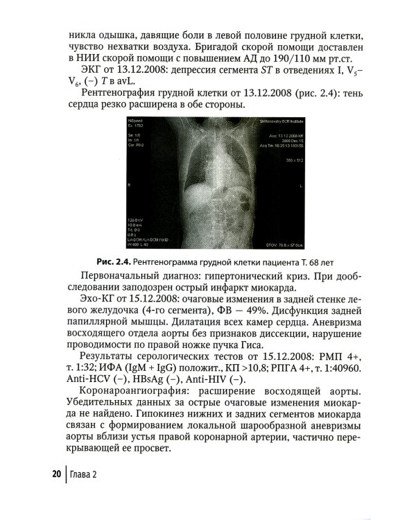 Поздние формы сифилиса с симптомами и без симптомов