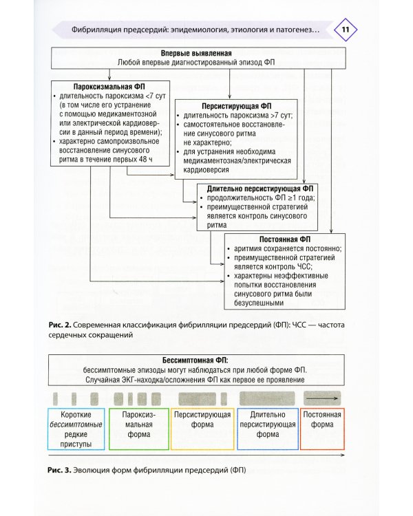 Фибрилляция предсердий: антикоагулянтная терапия в таблицах и схемах