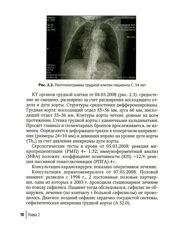 Поздние формы сифилиса с симптомами и без симптомов