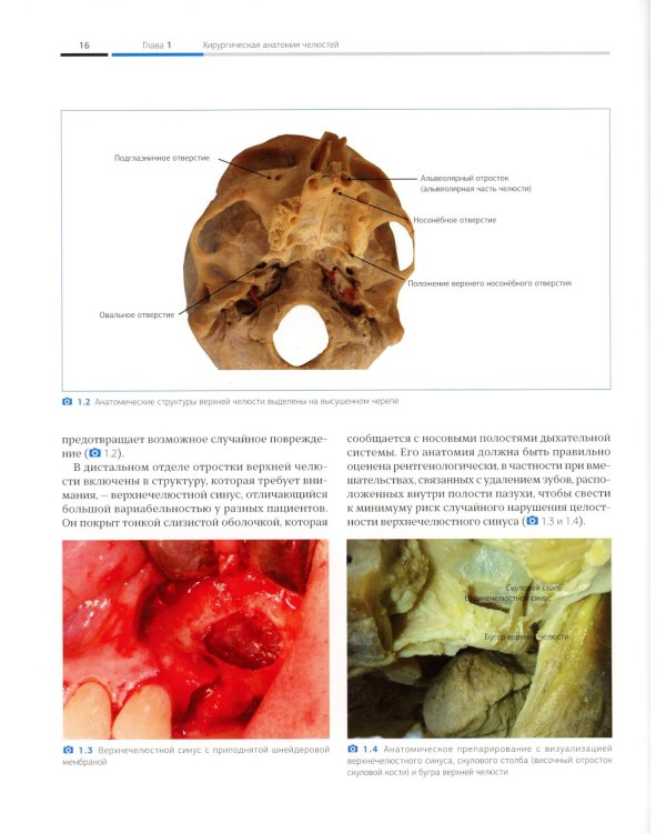 Пьезоэлектрическая хирургия импактных зубов