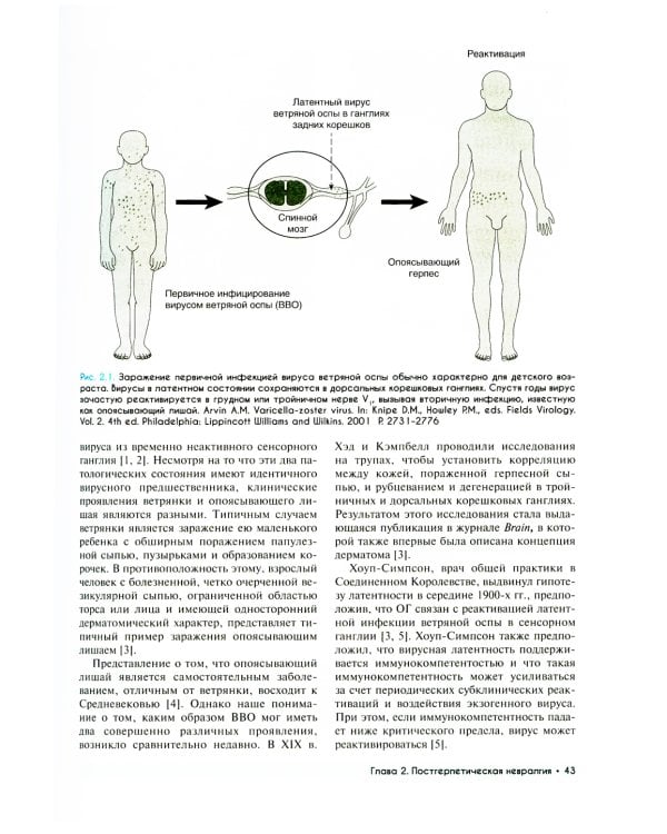 Медицина боли