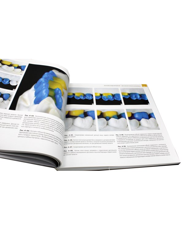 Постигая природу. Восковое моделирование эстетичных и функциональных окклюзионных поверхностей