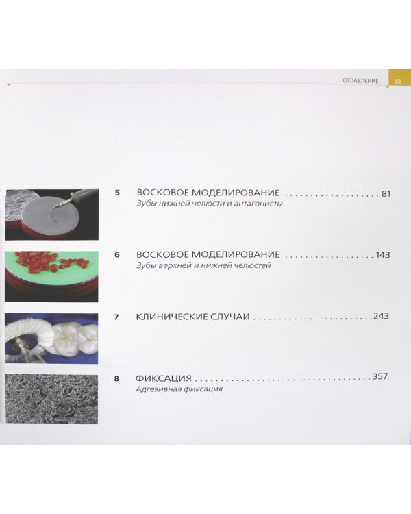 Постигая природу. Восковое моделирование эстетичных и функциональных окклюзионных поверхностей