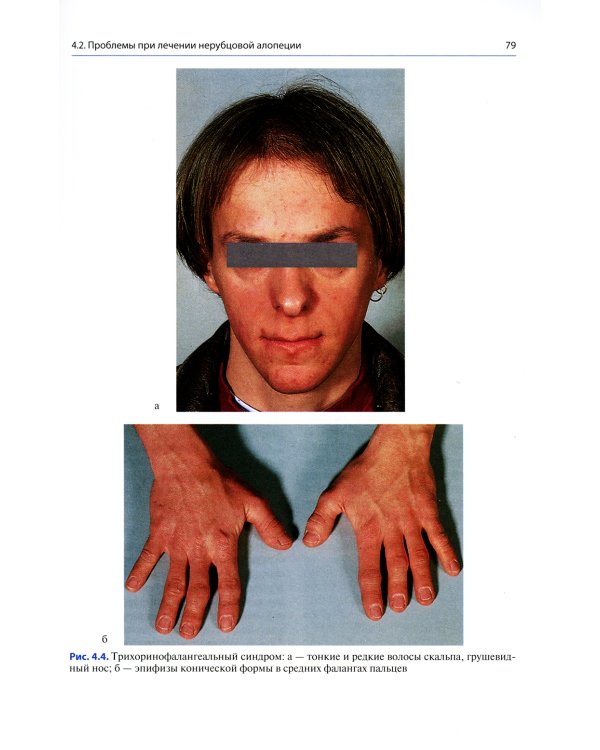 Сложный пациент трихолога: руководство по эффективному лечению алопеций и сопутствующих заболеваний