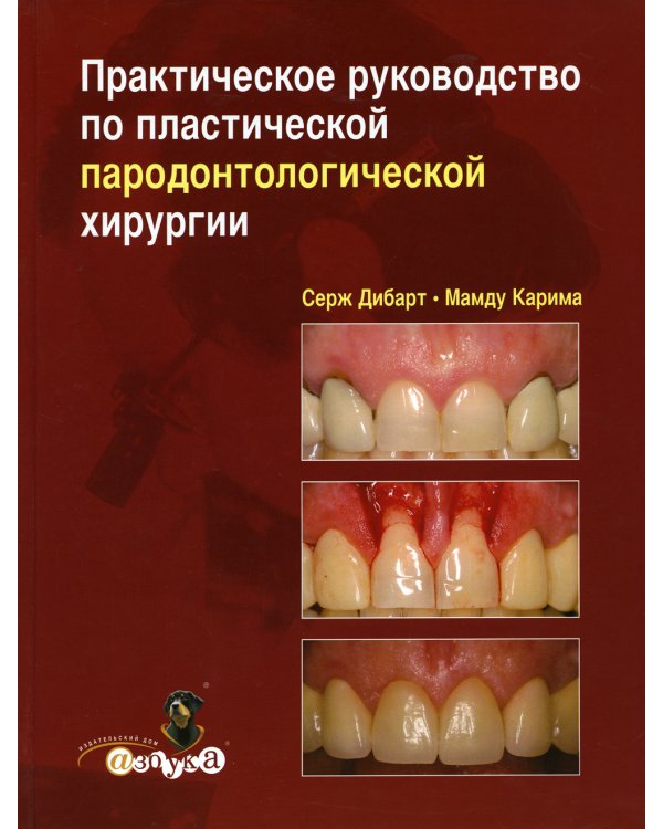 Практическое руководство по пластической парадонтологической хирургии