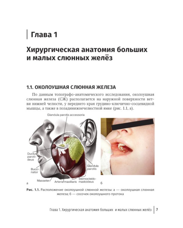 Слюннокаменная болезнь - сиалолитиаз: руководство для врачей
