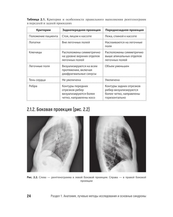 Лучевая диагностика органов грудной клетки у взрослых и детей