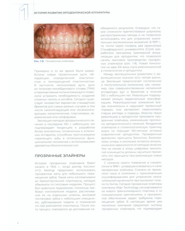 Прозрачные элайнеры