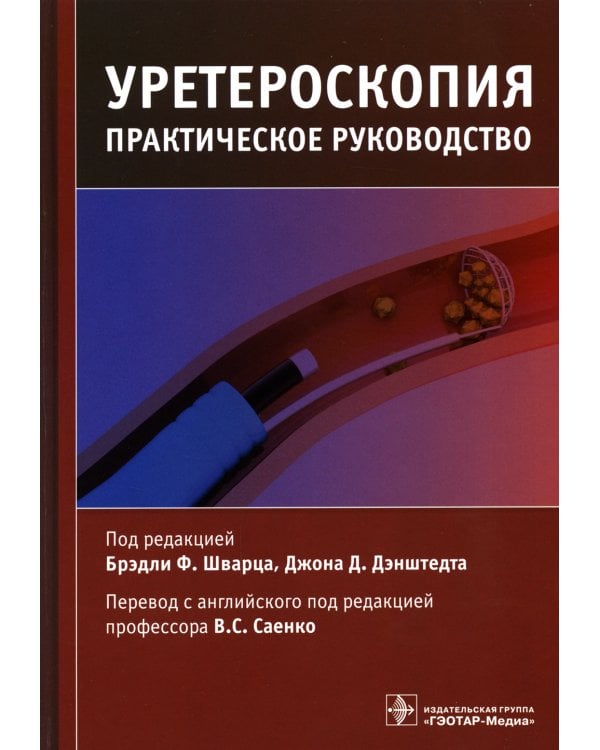 Уретероскопия: практическое руководство