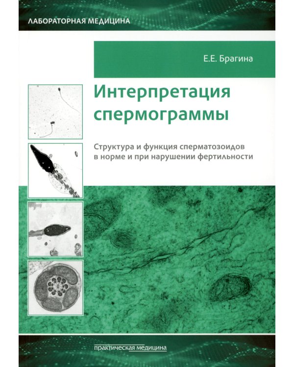 Интерпретация спермограммы. Структура и функция сперматозоидов в норме и при нарушении фертильности
