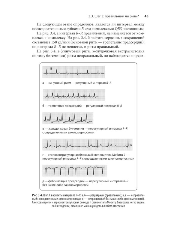 Карманный справочник по ЭКГ. 2-е изд., испр. и доп