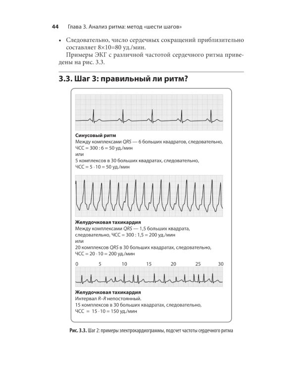 Карманный справочник по ЭКГ. 2-е изд., испр. и доп