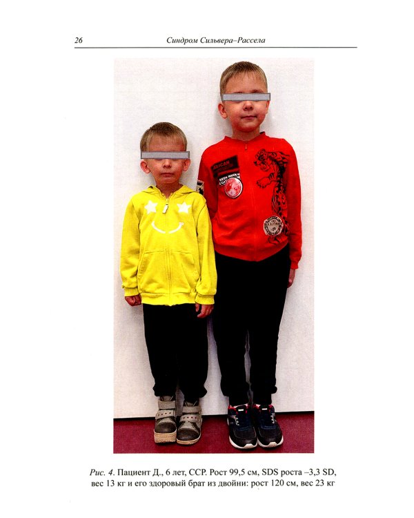 Синдром Сильвера-Рассела: клиника, диагностика, лечение: Учебно-методическое пособие