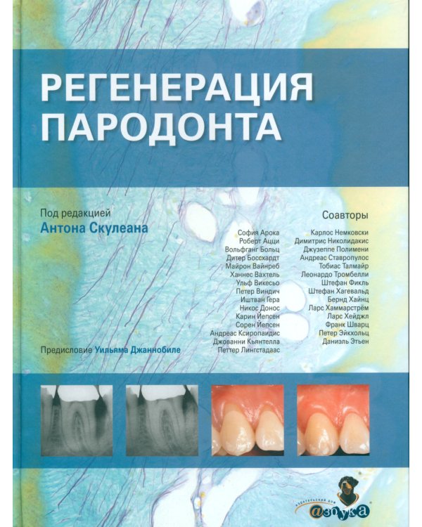 Регенерация пародонта