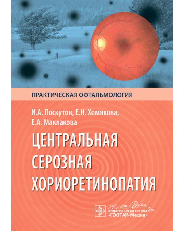 Центральная серозная хориоретинопатия
