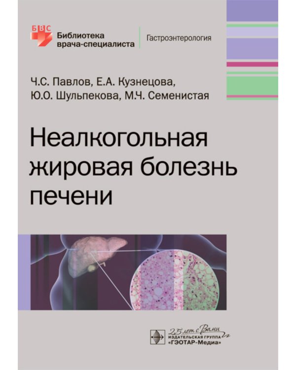 Неалкогольная жировая болезнь печени