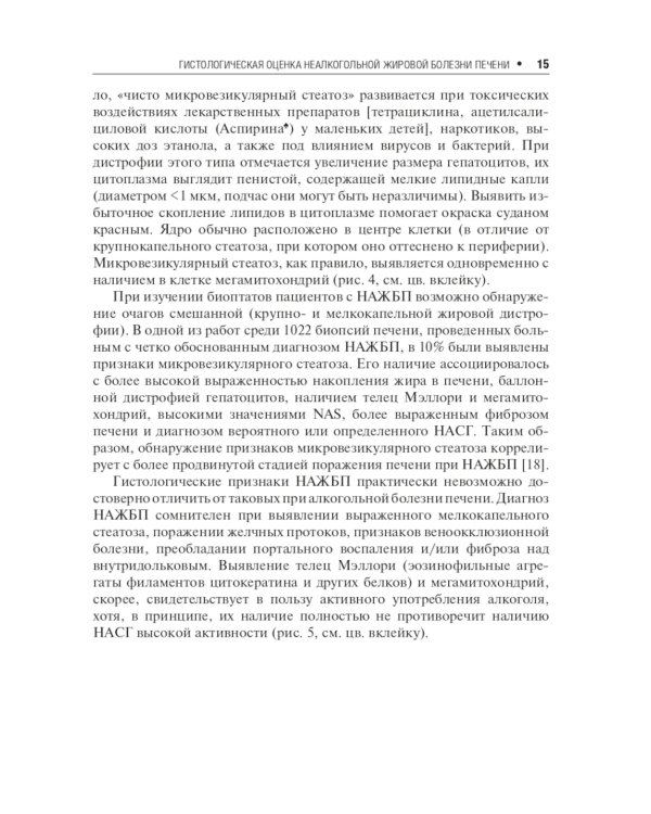 Неалкогольная жировая болезнь печени