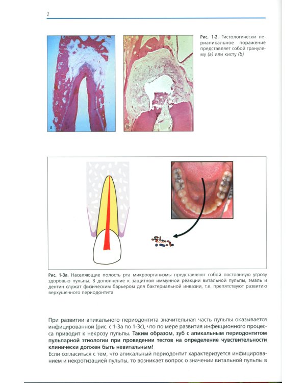 Руководство по эндодонтии для стоматолога общей практики