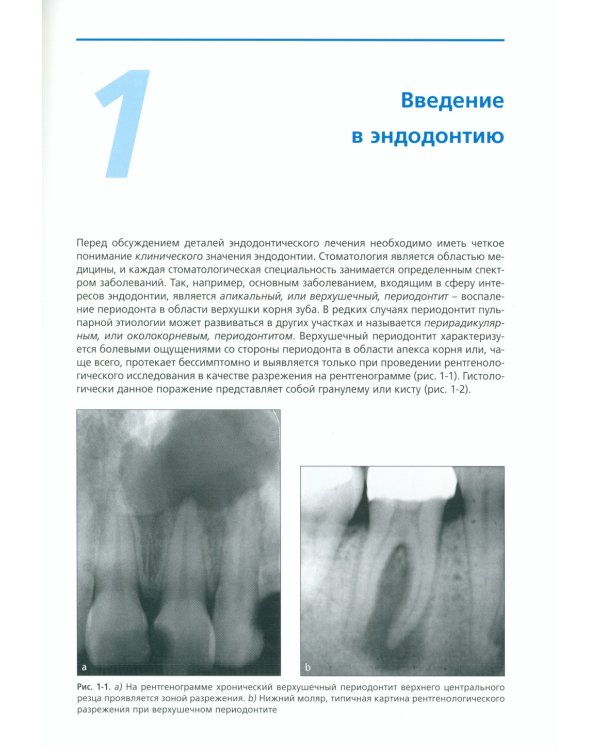 Руководство по эндодонтии для стоматолога общей практики