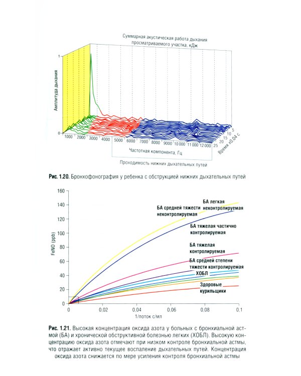 Детская пульмонология: национальное руководство. Краткое издание