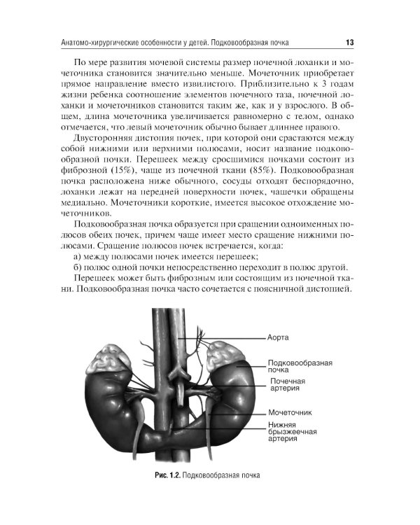 Хирургия подковообразных почек в детском возрасте: Учебное пособие
