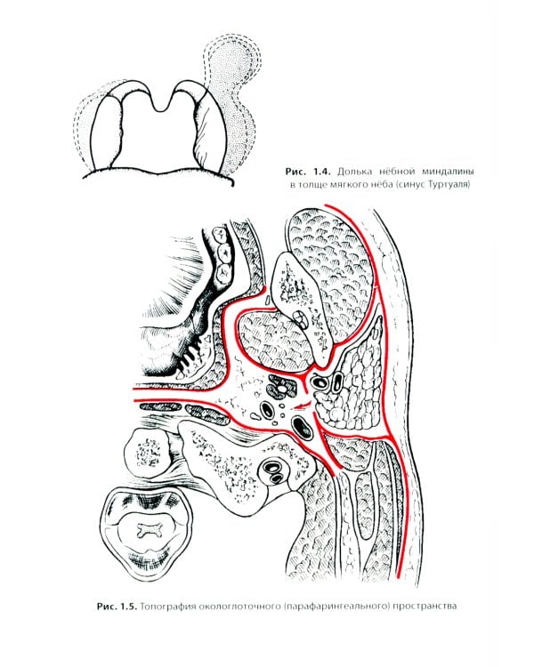 Воспалительные заболевания глотки: руководство для врачей. 2-е изд., доп. и перераб