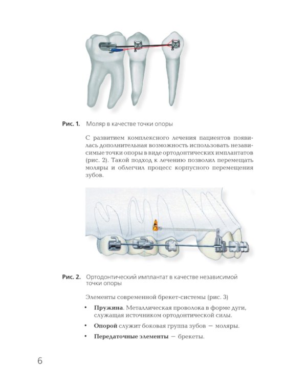 Брекет-системы. Современный взгляд: Учебное пособие