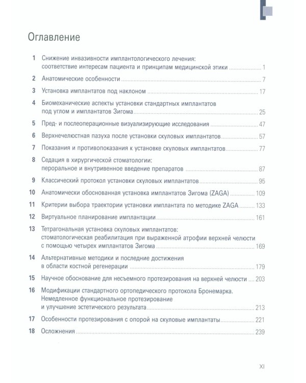 Скуловые имплантаты. Анатомический подход