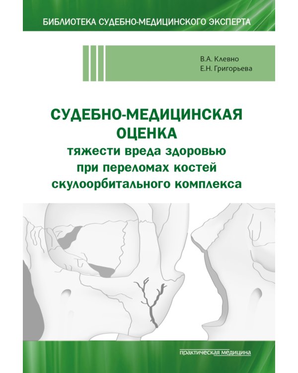 Судебно-медицинская оценка тяжести вреда здоровью при переломах костей скулоорбитального комплекса: монография