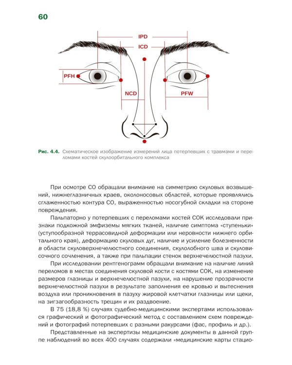 Судебно-медицинская оценка тяжести вреда здоровью при переломах костей скулоорбитального комплекса: монография