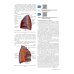 Практическое руководство по торакальной хирургии