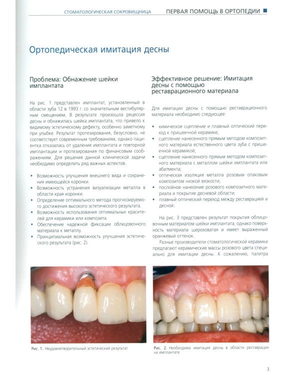 Стоматологическая сокровищница. Советы и секреты практического стоматолога. Т. 2