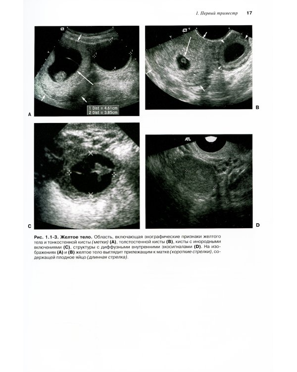 Атлас по ультразвуковой диагностике в акушерстве и гинекологии. 4-е изд