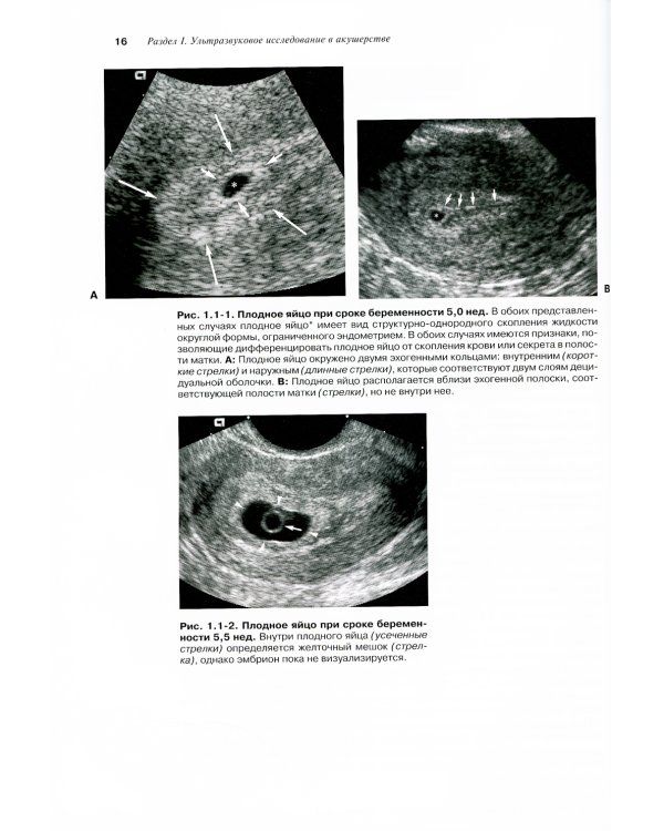 Атлас по ультразвуковой диагностике в акушерстве и гинекологии. 4-е изд