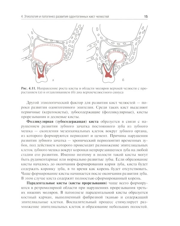 Одонтогенные кисты челюстей: Учебное пособие. 2-е изд., испр. и доп