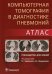 Компьютерная томография в диагностике пневмоний. Атлас: руководство для врачей
